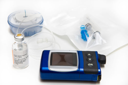 Insulin pump, courtesy of Shutterstock